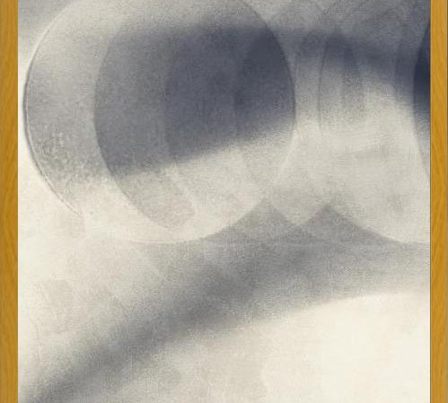 Cuadro ECLIPSE #1